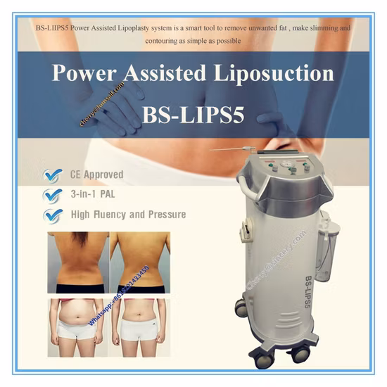 Fat Grafting Resonance Ancillary Surgical Liposuction Machine for Body Slimming