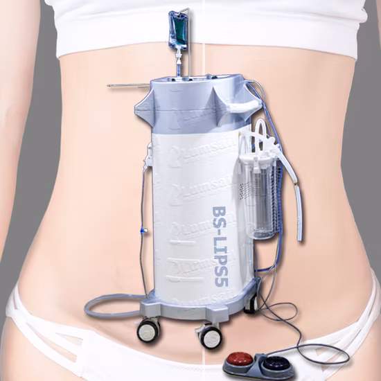 Fat Grafting Resonance Ancillary Surgical Liposuction Machine for Body Slimming