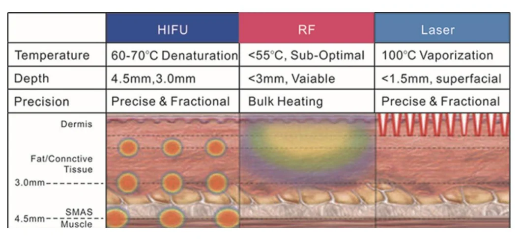 4MHz Hifu Face Lift and Body Slimming Beauty Machine