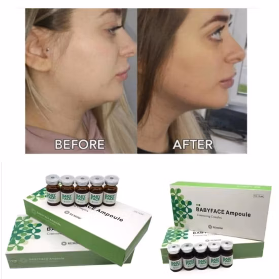 Heißer tragbarer Hifu Ultrashape Vertikaler Gewichtsverlust Liposonix