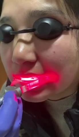 CE-zugelassenes 980-nm-Zahnaufhellungs-Diodenlaser-Dentalgerät für Parodontitis